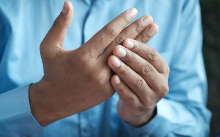 personne en chemise bleue montrant la main gauche - inflammation